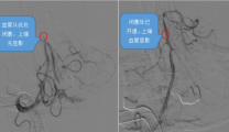 生死竞速！多学科协作打通“生命通道”